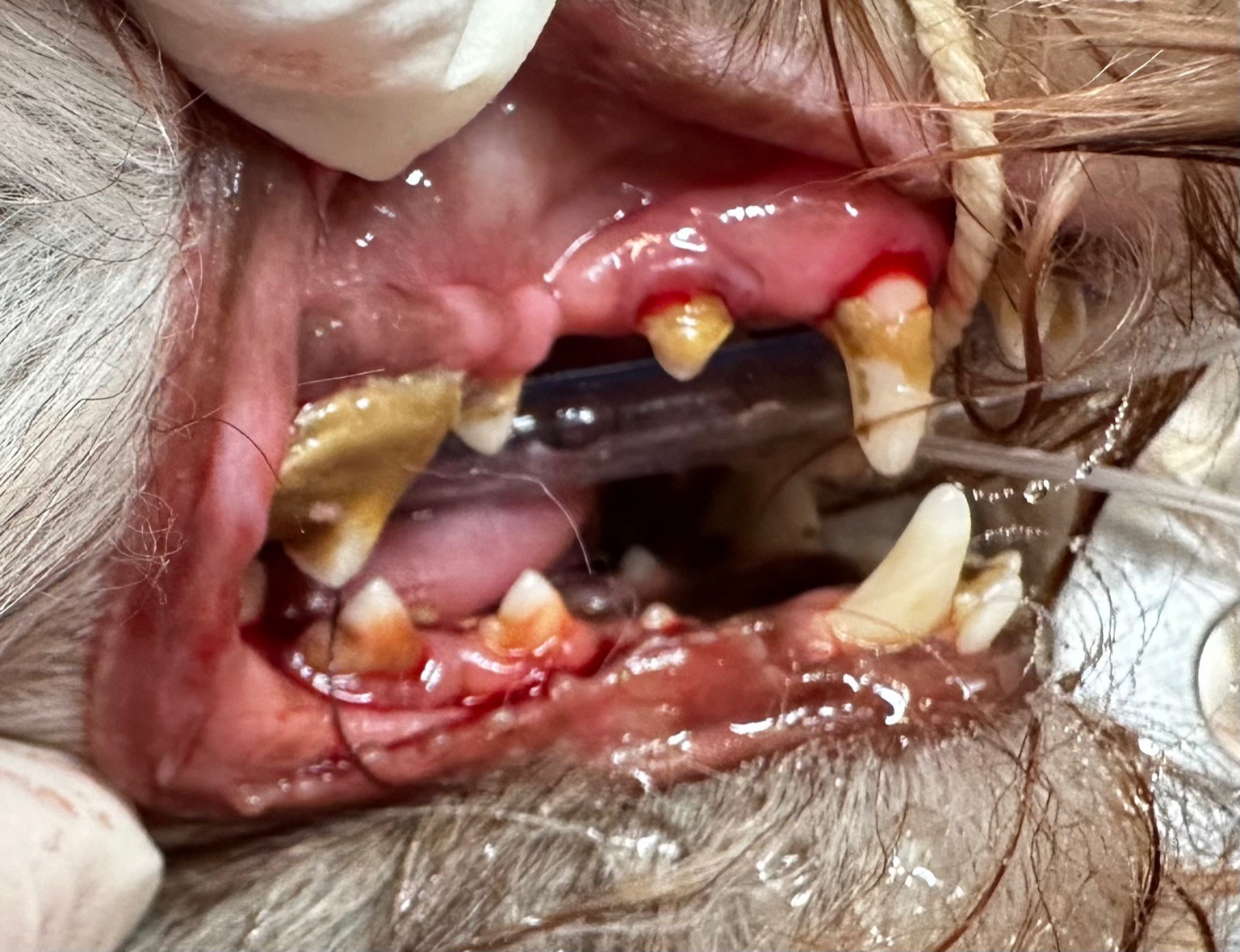 Vue latérale de dents avec accumulation de tartre.