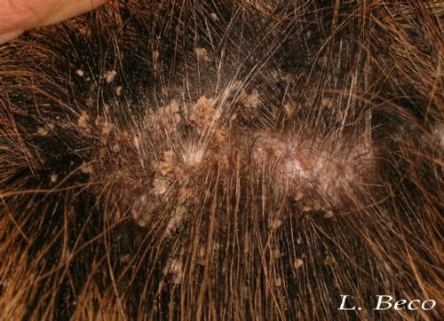 Pellicules qui marchent chez le chat